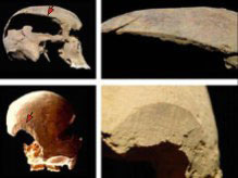 Mulktiple Views of Skull Excavated from Hrisbrú Cemetery Showing Wounds